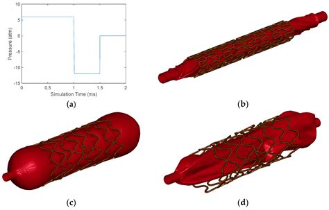 Simplified Models to Assess the Mechanical Performance Parameters of Stents