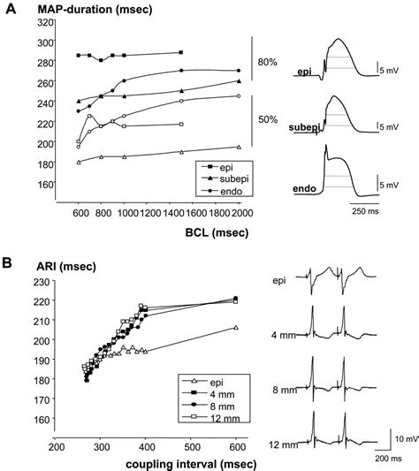 Right Ventricular Fibrosis and Conduction Delay in a Patient With ...