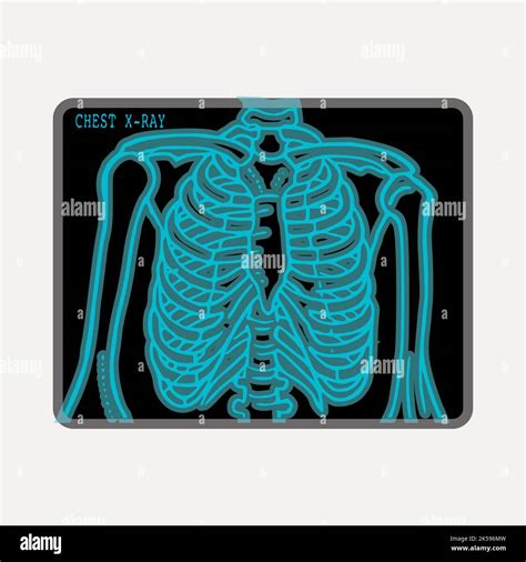 Clipart X Ray X Ray Clipart Etsy UK