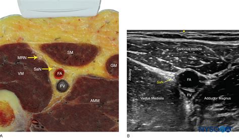 Ramo Infrapatelar Do Nervo Safeno Articulação Do Joelho: Anatomia,