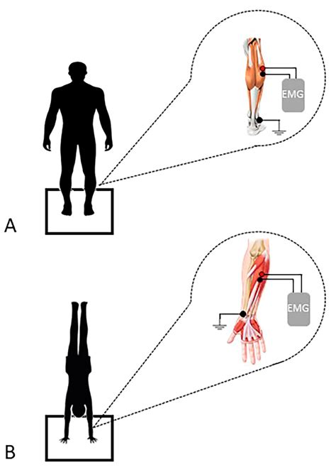Evaluation of Posturographic and Neuromuscular Parameters during ...