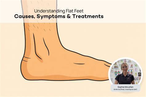 Flat Feet - Podiatry Corner – Comfort Co Shoes Australia