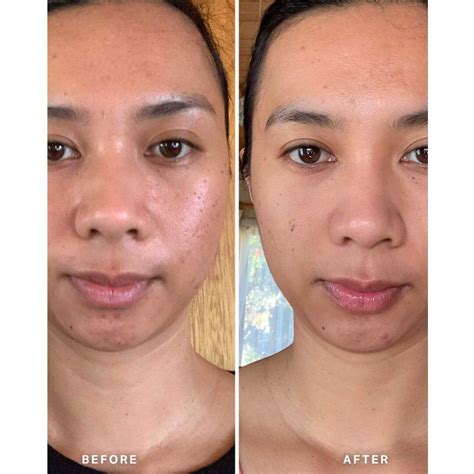 How to Fade Dark Spots with Vitamin C Serum – Glopetra