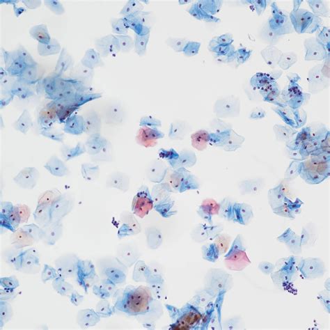 What Is A Cytology Smear at Emily Armytage blog