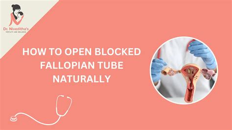 Image result for Fallopian Tube Replacement Surgery