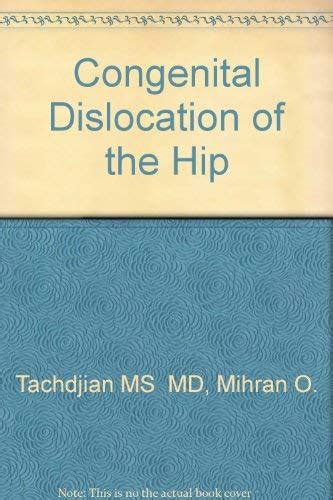 Buy Congenital Dislocation of the Hip Book Online at Low Prices in ...