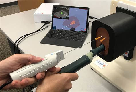 Prostate Radiation Simulation 的图像结果