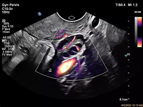 Philips - EPIQ Elite A new class of premium ultrasound has arrived