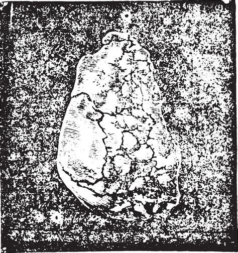 Calculation of sodium urate enchatonne in the bladder mucosa and 35388392 Vector Art at Vecteezy