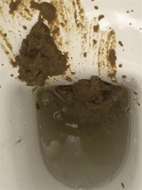 Exploding Poop Human 的图像结果