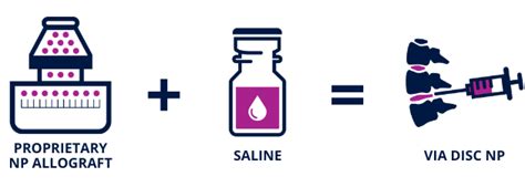 Image result for Via Disc Procedure