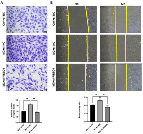 PIEZO1 Promotes the Migration of Endothelial Cells via Enhancing CXCR4 ...