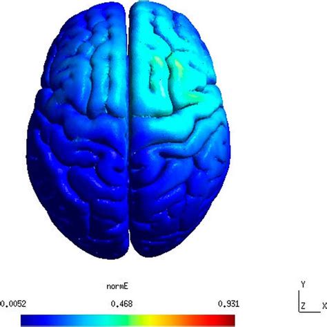 Image result for Dorsolateral Prefrontal Cortex