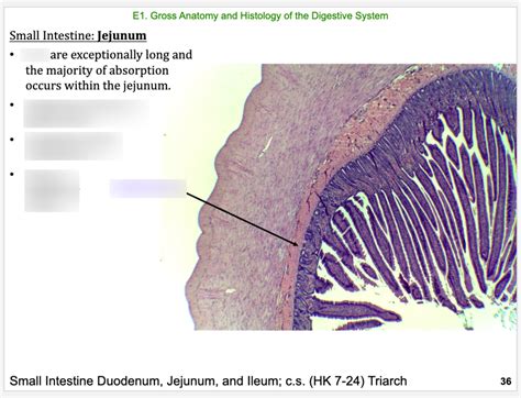 Image result for Small Intestine Jejunum