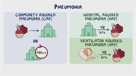 Ventilator Associated Pneumonia Definition Ventilator Associated Pneumonia