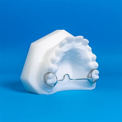 Transpalatal Arch - Specialty Appliances