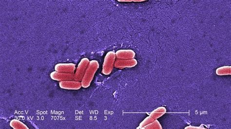 Microscope Bacteria 的图像结果