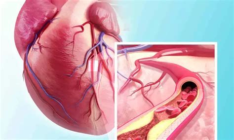 Cardiology team performs transcatheter edge-to-edge repair with newly ...