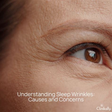Want Fewer Wrinkles While You Sleep?