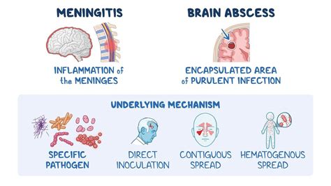 Meningitis and brain abscess: Video & Meaning | Osmosis