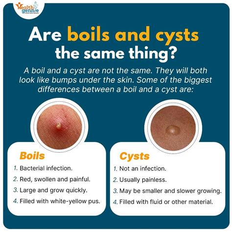 Image result for boils cysts abscesses exploding