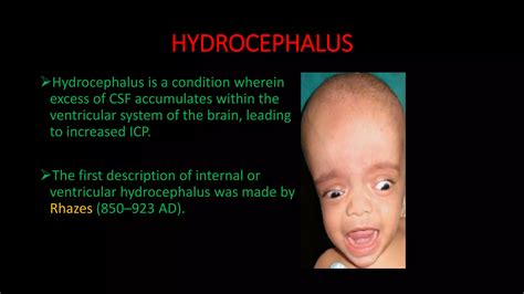 Csf pathway and hydrocephalus | PPTX