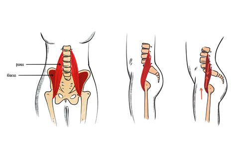 Relieve Back Pain: Fix Pelvic Tilt with Posture Tips