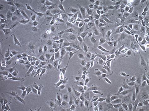 C28/I2 Human Chondrocyte Cell Line | SCC043