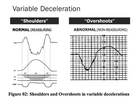 Index of /wp-content/uploads/2018/12/