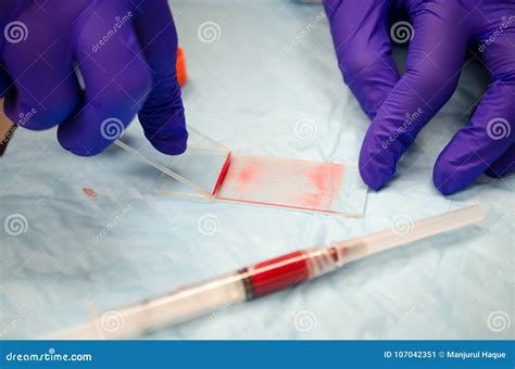 Preparation of Blood Slide for Diagnosis Stock Image - Image of microscope, clinical: 107042351