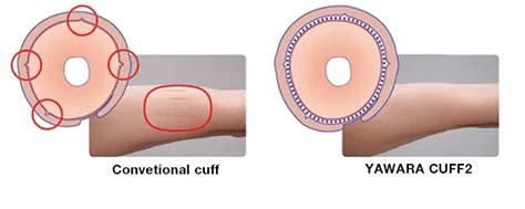 NIBP Cuffs