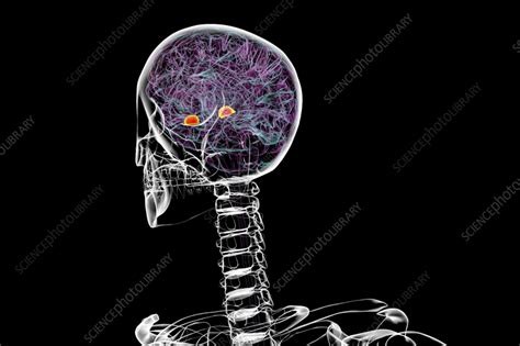 Image result for Amygdala Example