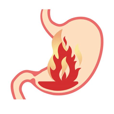 Acidity In Hindi: A Simple Definition