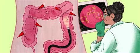 Image result for Why Colonoscopy Test Is Done