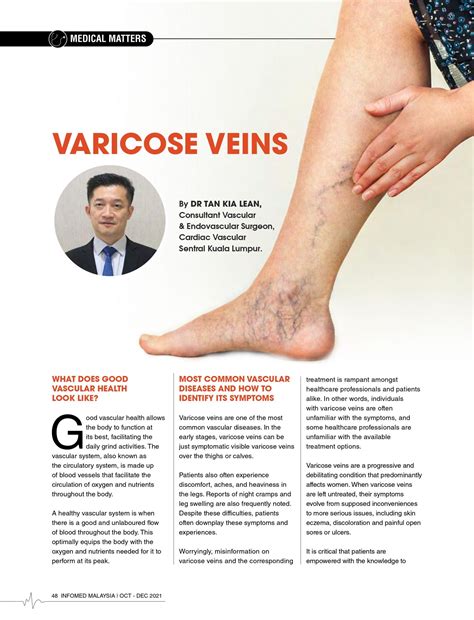 Varicose Veins Feet Varicose Veins In The Feet And Ankles