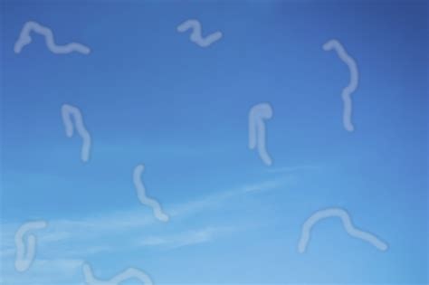 Something flashes and floats in my vision - Eyecare Network