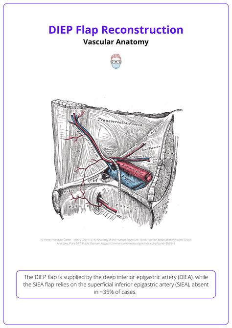 Diep Flap Procedure
