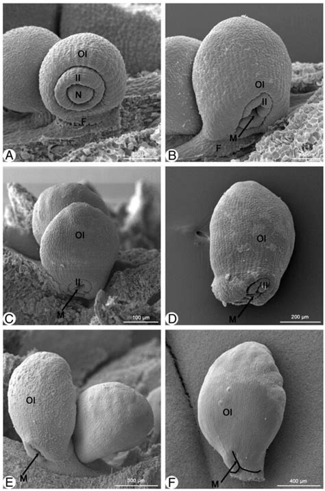How Seeds Attract and Protect: Seed Coat Development of Magnolia