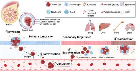 Brain Lung Liver Bone Metastases