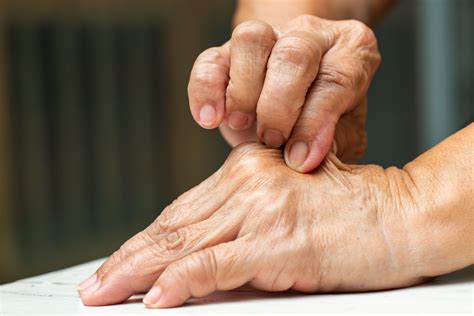 What Is Skin Turgor?