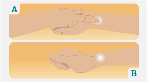 Migraine Relief Pressure Points