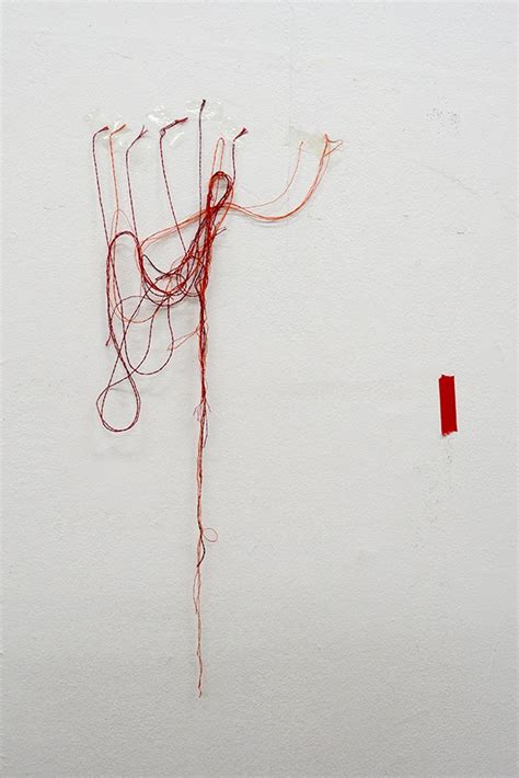 Image result for String ENT