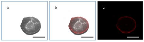Biodegradable Nanoparticles-Loaded PLGA Microcapsule for the Enhanced ...