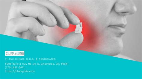 Infected Tooth Extraction Procedure 的图像结果
