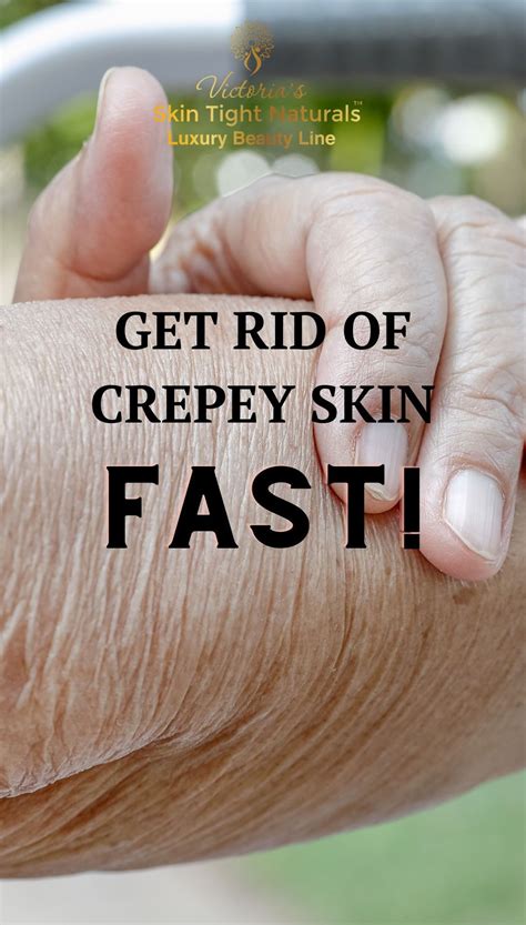 Get Rid Of Crepey Skin Fast! | Skin care wrinkles, Crepey skin, Skin care remedies
