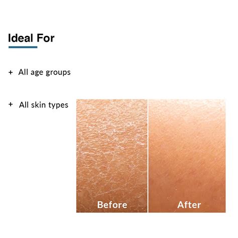Best Moisturizing Lotion in India – Fixderma Skincare