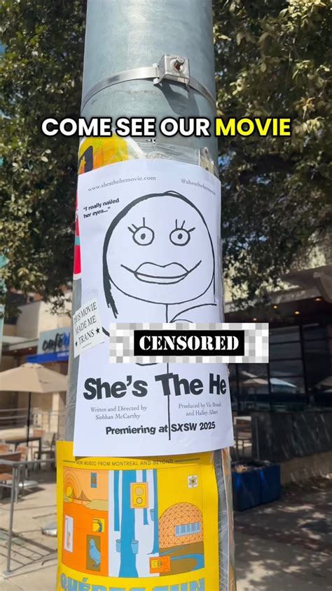 Emmett Preciado | The donor site won’t be hairy as long as Electrolysis is done for about a year ...