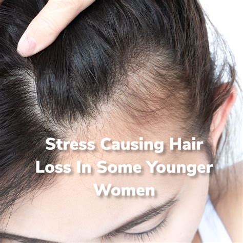 Stress Hair Loss