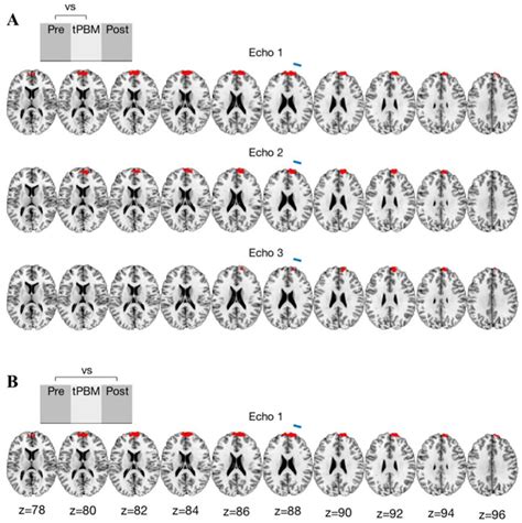 Grant Report on the Transcranial near Infrared Radiation and Cerebral ...