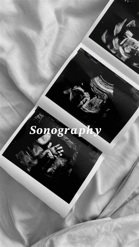 Sonography in 2025 | Ultrasound technician, Diagnostic medical sonography, Sonography student